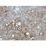 Immunohistochemistry - Pyruvate Kinase (liver/RBC) antibody from Signalway Antibody (22570) - Antibodies.com