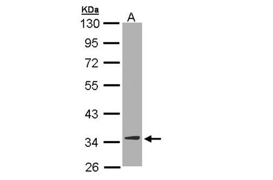 DECR1 antibody from Signalway Antibody (22016) - Antibodies.com