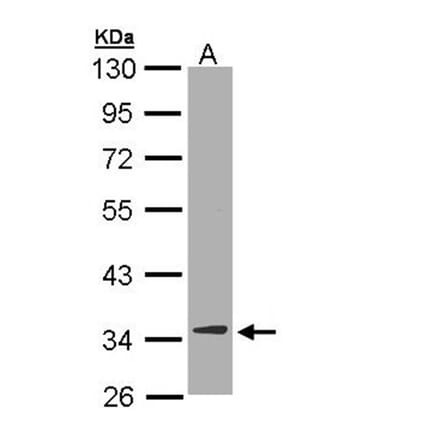DECR1 antibody from Signalway Antibody (22016) - Antibodies.com