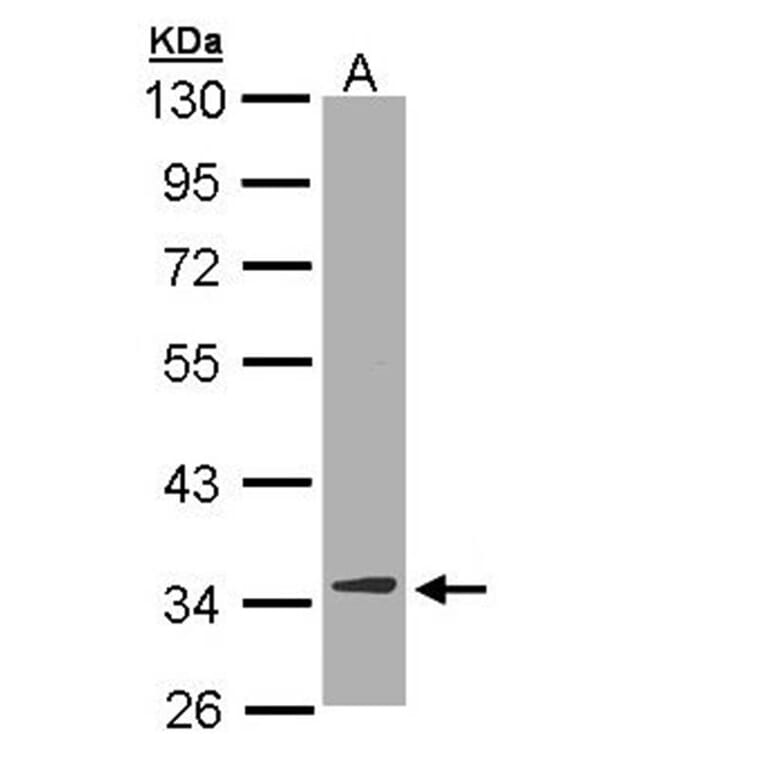 DECR1 antibody from Signalway Antibody (22016) - Antibodies.com