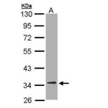 DECR1 antibody from Signalway Antibody (22016) - Antibodies.com