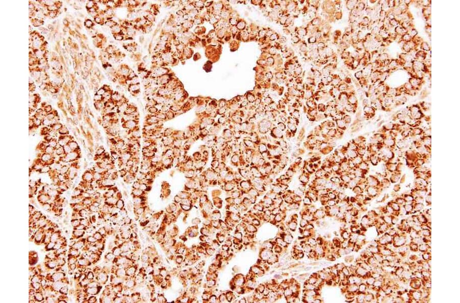 Immunohistochemistry - DECR1 antibody from Signalway Antibody (22016) - Antibodies.com
