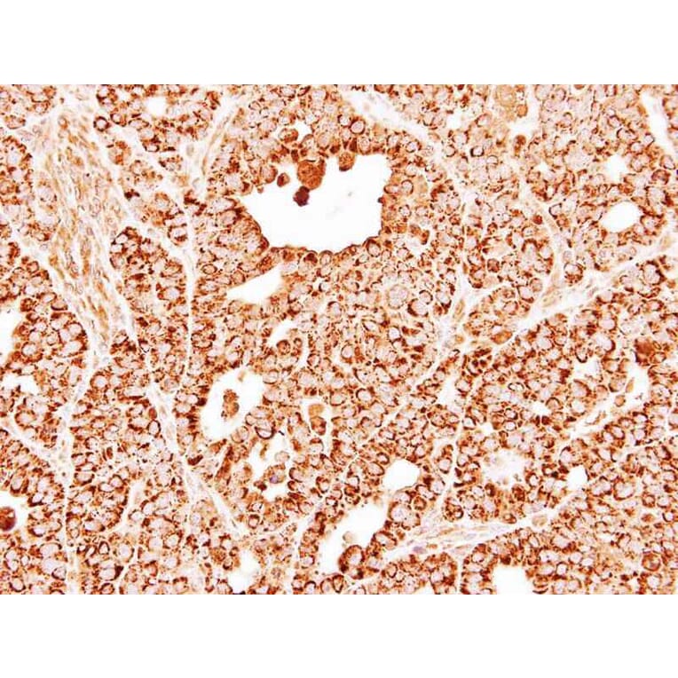 Immunohistochemistry - DECR1 antibody from Signalway Antibody (22016) - Antibodies.com