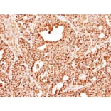Immunohistochemistry - DECR1 antibody from Signalway Antibody (22016) - Antibodies.com