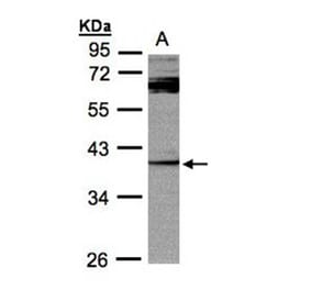 PYST2 antibody from Signalway Antibody (22021) - Antibodies.com