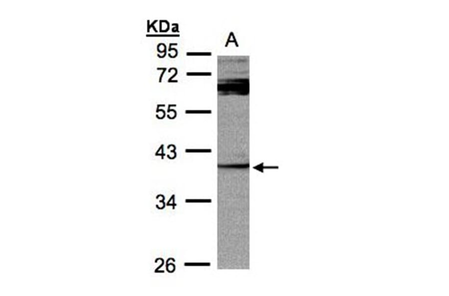 PYST2 antibody from Signalway Antibody (22021) - Antibodies.com