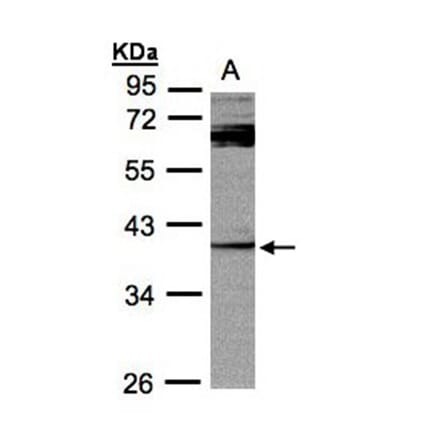 PYST2 antibody from Signalway Antibody (22021) - Antibodies.com