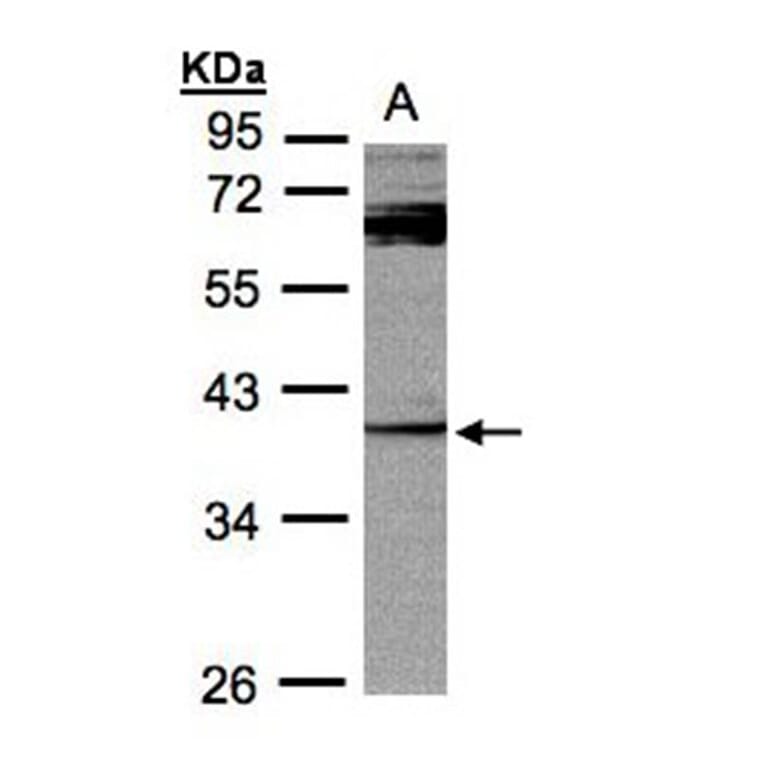 PYST2 antibody from Signalway Antibody (22021) - Antibodies.com