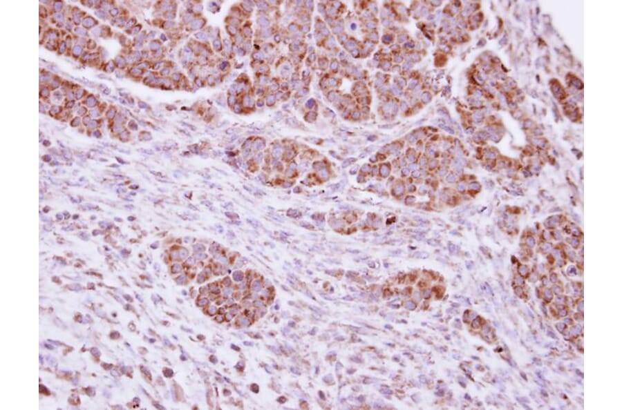 Immunohistochemistry - PYST2 antibody from Signalway Antibody (22021) - Antibodies.com
