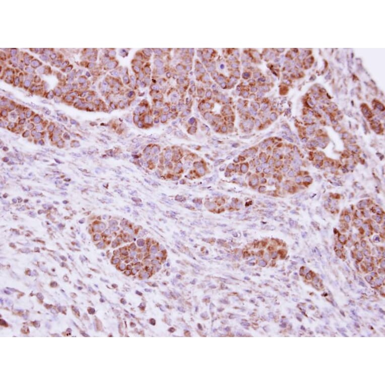 Immunohistochemistry - PYST2 antibody from Signalway Antibody (22021) - Antibodies.com