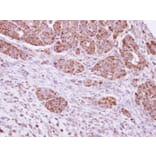 Immunohistochemistry - PYST2 antibody from Signalway Antibody (22021) - Antibodies.com