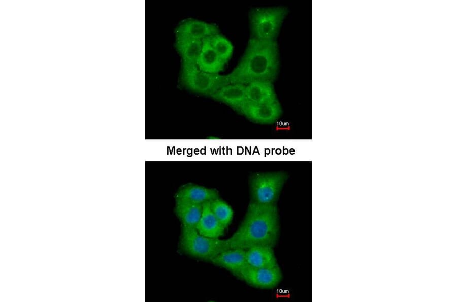 Immunofluorescence - PYST2 antibody from Signalway Antibody (22021) - Antibodies.com