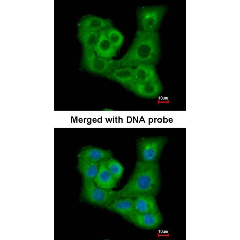 Immunofluorescence - PYST2 antibody from Signalway Antibody (22021) - Antibodies.com
