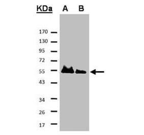 HICE1 antibody from Signalway Antibody (22053) - Antibodies.com