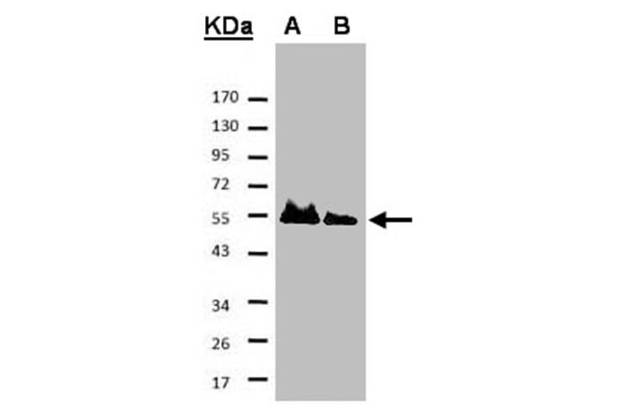 HICE1 antibody from Signalway Antibody (22053) - Antibodies.com