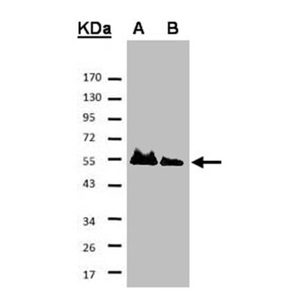 HICE1 antibody from Signalway Antibody (22053) - Antibodies.com