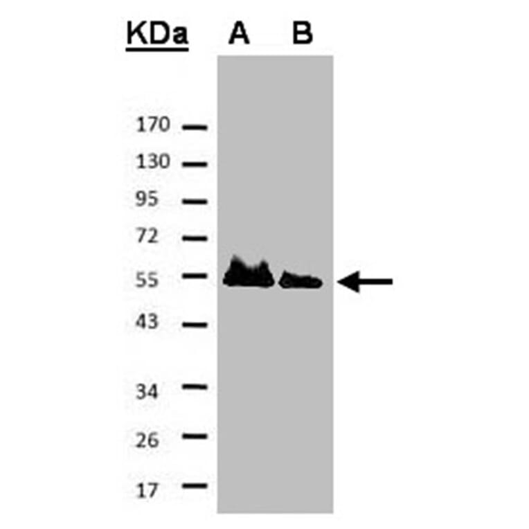 HICE1 antibody from Signalway Antibody (22053) - Antibodies.com