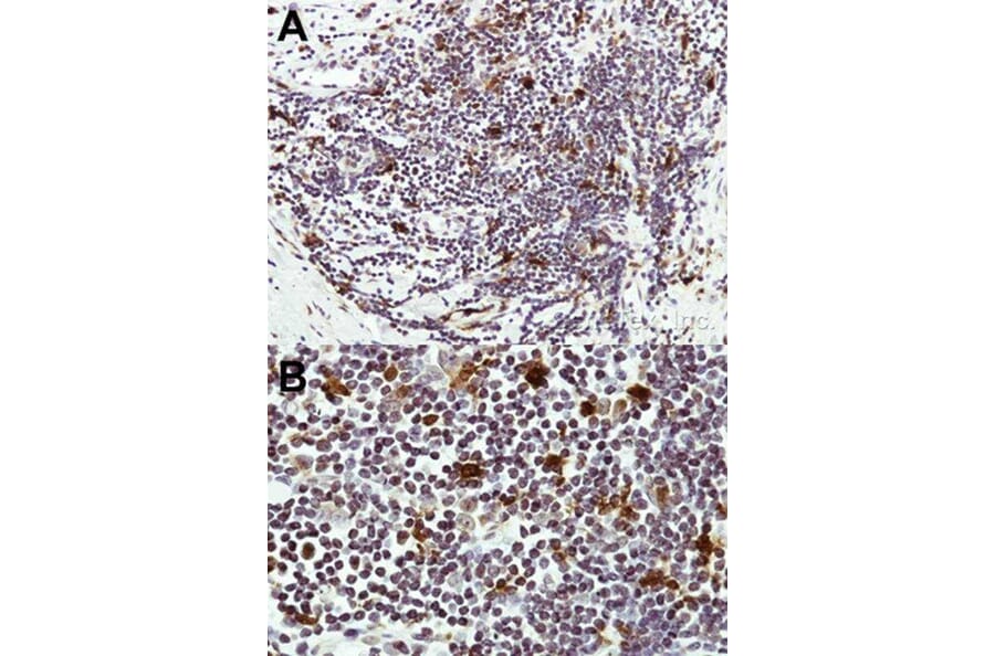 Immunohistochemistry - HICE1 antibody from Signalway Antibody (22053) - Antibodies.com