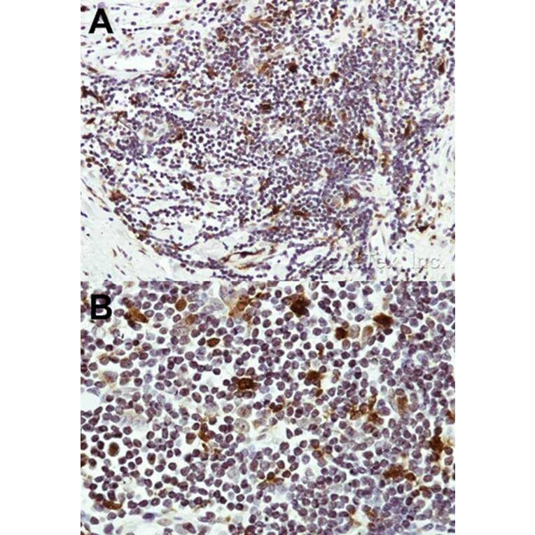 Immunohistochemistry - HICE1 antibody from Signalway Antibody (22053) - Antibodies.com