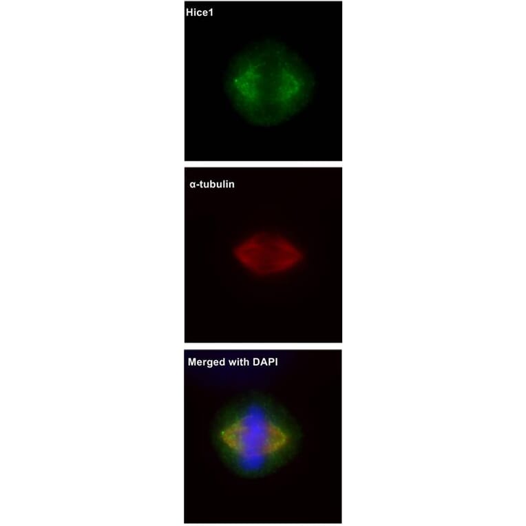 Immunofluorescence - HICE1 antibody from Signalway Antibody (22053) - Antibodies.com