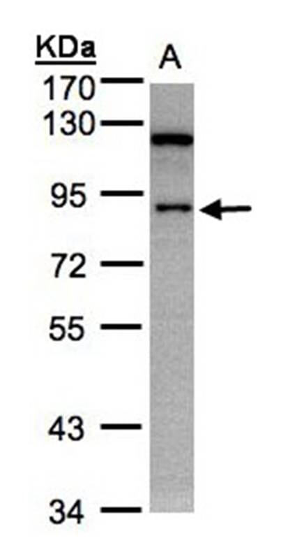 Sample (30 µg whole cell lysate) A431 7.5% SDS PAGE Primary antibody diluted at 1: 5000