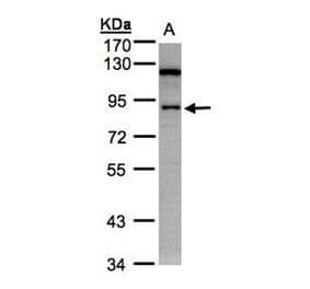 SART1 antibody from Signalway Antibody (22063) - Antibodies.com