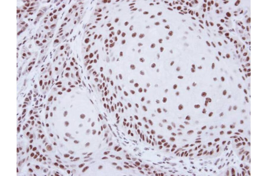 Immunohistochemistry - SART1 antibody from Signalway Antibody (22063) - Antibodies.com