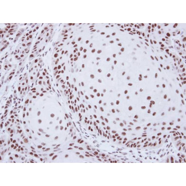 Immunohistochemistry - SART1 antibody from Signalway Antibody (22063) - Antibodies.com