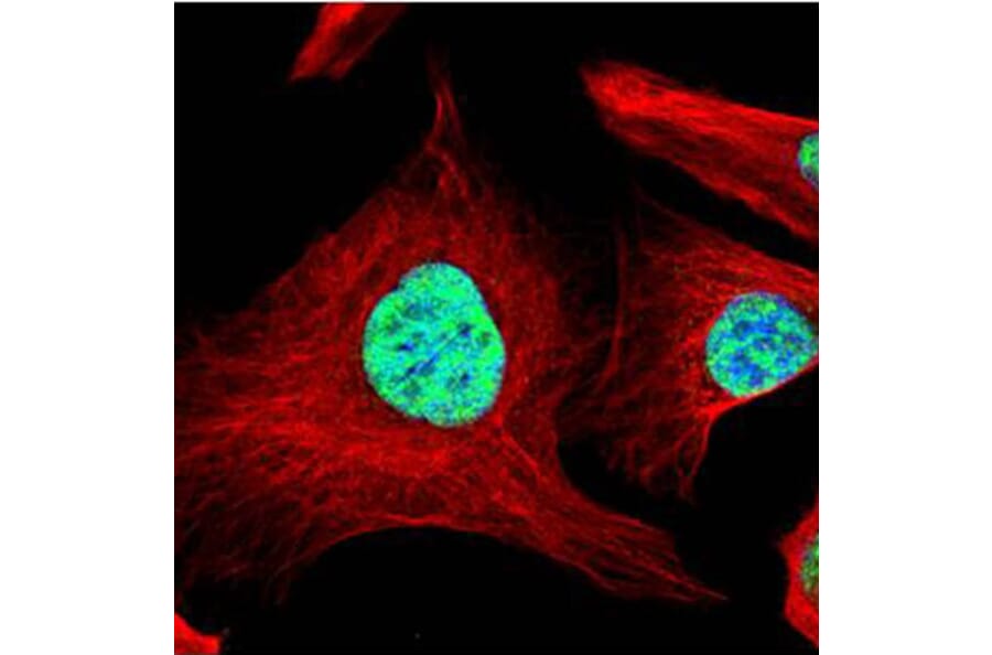 SART1 antibody from Signalway Antibody (22063) - Antibodies.com