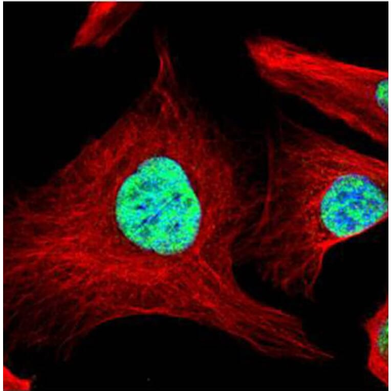 SART1 antibody from Signalway Antibody (22063) - Antibodies.com