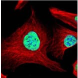 SART1 antibody from Signalway Antibody (22063) - Antibodies.com