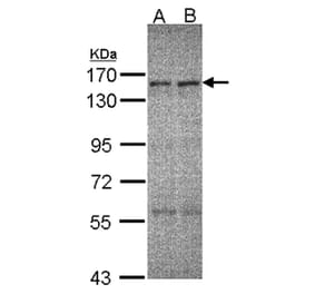 ERCC6 antibody from Signalway Antibody (22065) - Antibodies.com