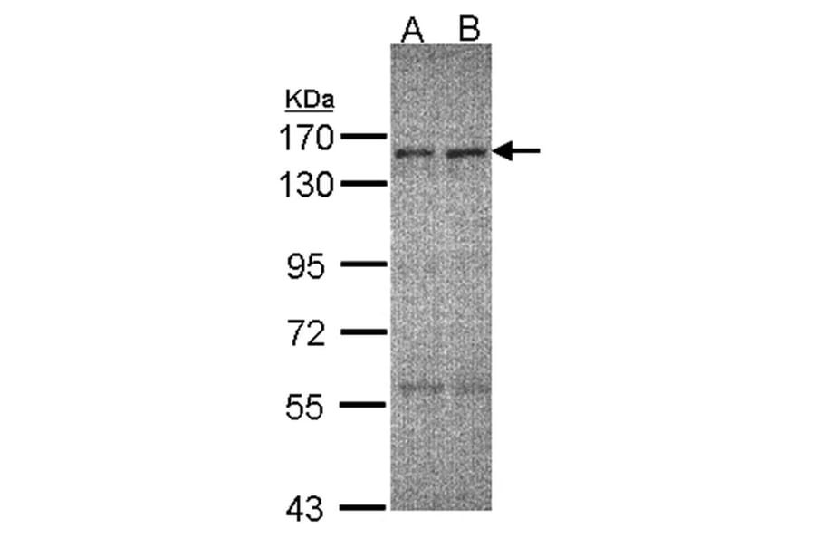ERCC6 antibody from Signalway Antibody (22065) - Antibodies.com