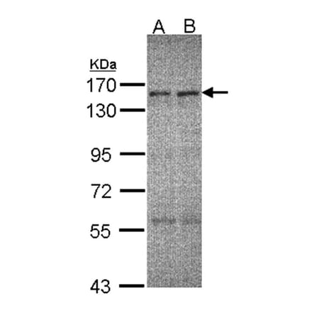 ERCC6 antibody from Signalway Antibody (22065) - Antibodies.com