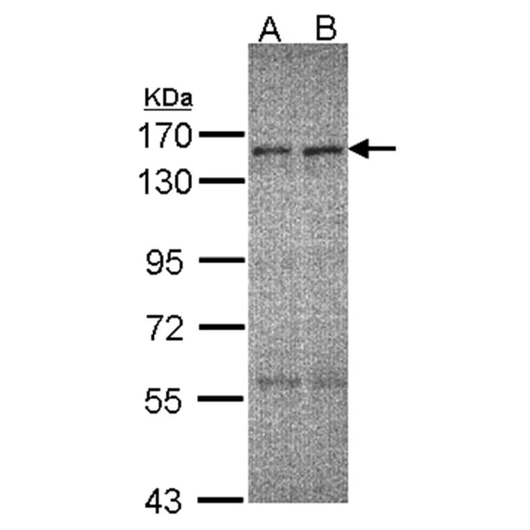 ERCC6 antibody from Signalway Antibody (22065) - Antibodies.com