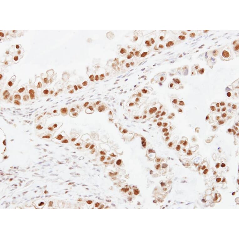 Immunohistochemistry - ERCC6 antibody from Signalway Antibody (22065) - Antibodies.com