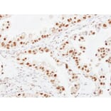 Immunohistochemistry - ERCC6 antibody from Signalway Antibody (22065) - Antibodies.com