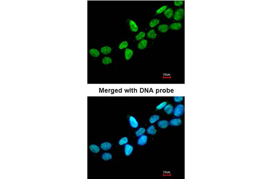 Immunofluorescence - ERCC6 antibody from Signalway Antibody (22065) - Antibodies.com