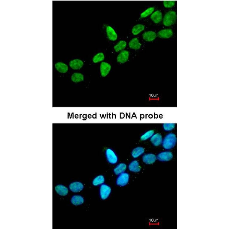 Immunofluorescence - ERCC6 antibody from Signalway Antibody (22065) - Antibodies.com