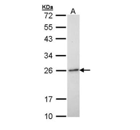 RAB6A antibody from Signalway Antibody (22075) - Antibodies.com