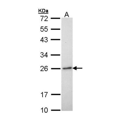 RAB6A antibody from Signalway Antibody (22075) - Antibodies.com