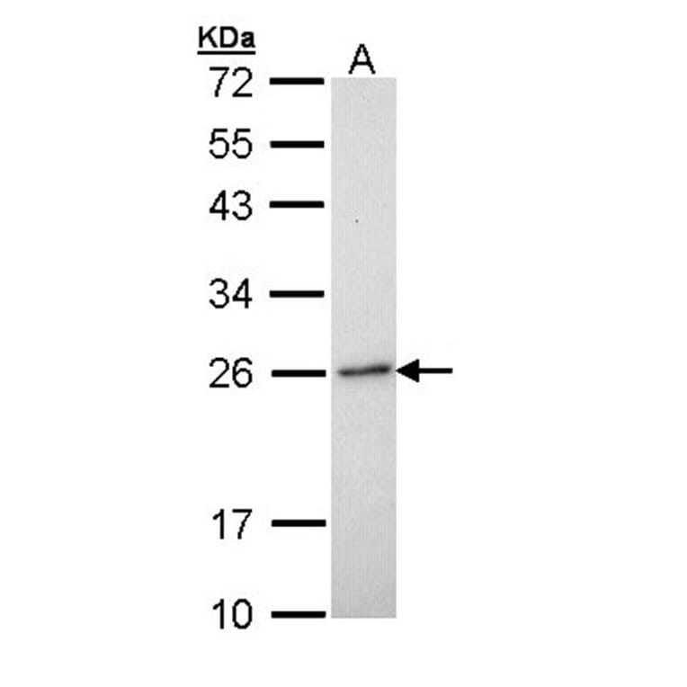 RAB6A antibody from Signalway Antibody (22075) - Antibodies.com