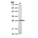 RAB6A antibody from Signalway Antibody (22075) - Antibodies.com