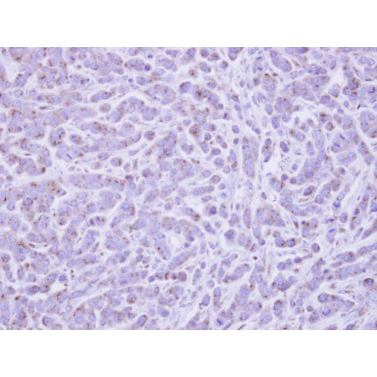 Immunohistochemistry - RAB6A antibody from Signalway Antibody (22075) - Antibodies.com