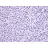 Immunohistochemistry - RAB6A antibody from Signalway Antibody (22075) - Antibodies.com