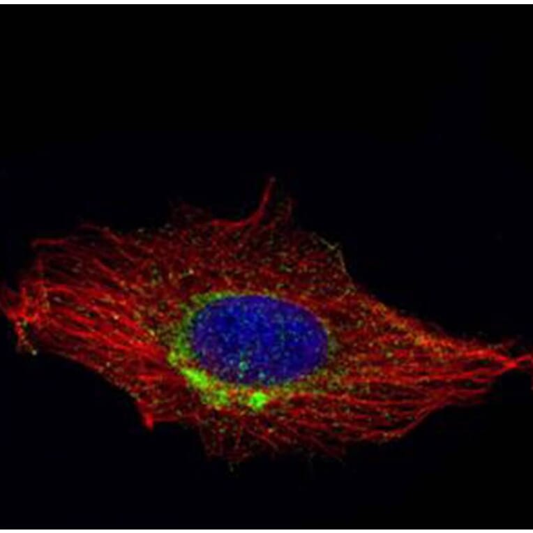 RAB6A antibody from Signalway Antibody (22075) - Antibodies.com