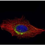 RAB6A antibody from Signalway Antibody (22075) - Antibodies.com