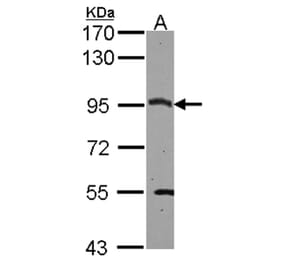 CSDE1 antibody from Signalway Antibody (22089) - Antibodies.com