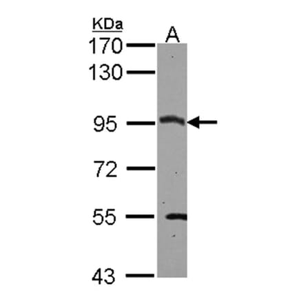 CSDE1 antibody from Signalway Antibody (22089) - Antibodies.com