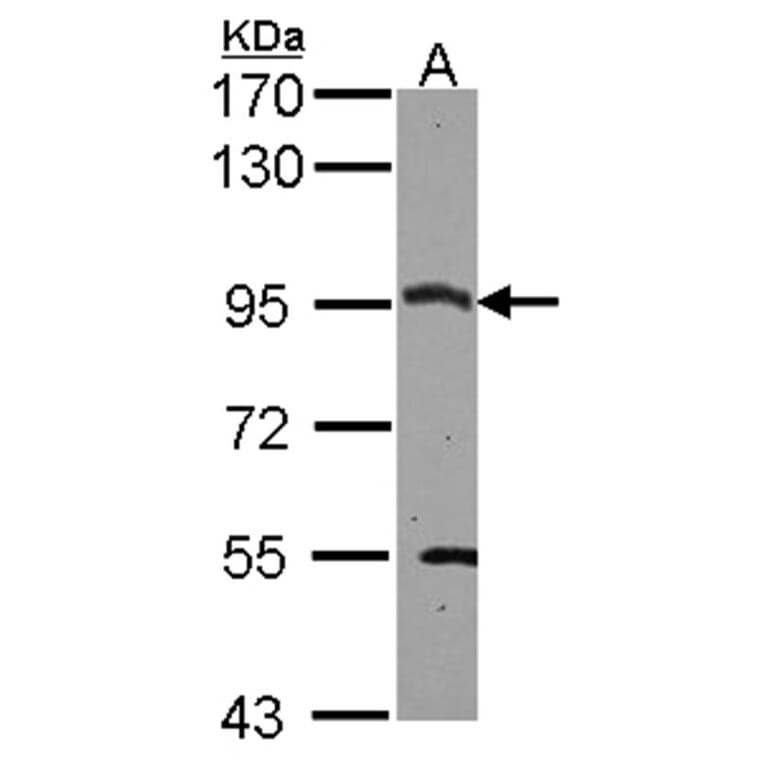 CSDE1 antibody from Signalway Antibody (22089) - Antibodies.com